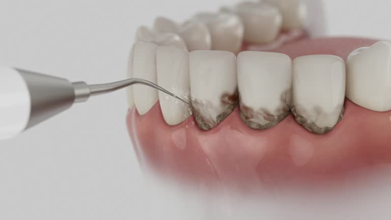 Trusted Teeth Cleaning And Checkup service in Shark River Hills, NJ - Dentist Open Now